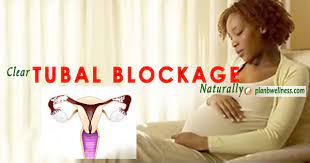 natural remedy for blocked fallopian tube