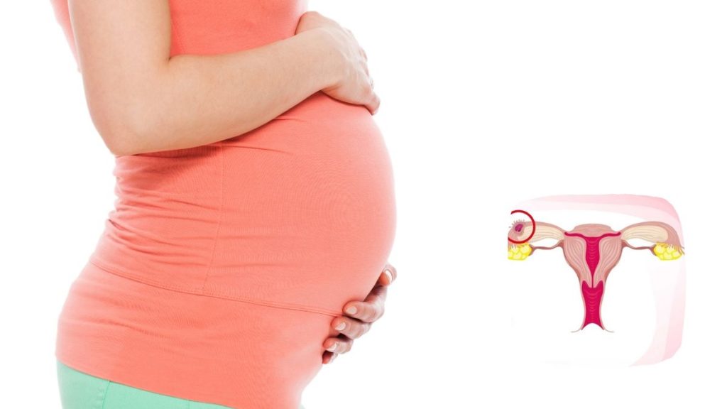 how tubal blockage prevents pregnancy