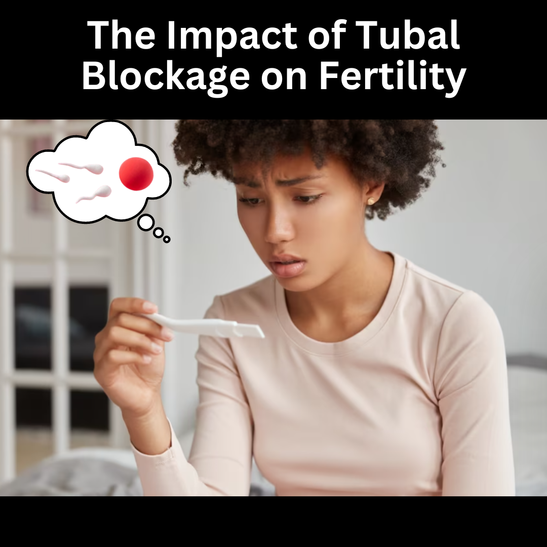 The Impact of Tubal Blockage on Fertility
